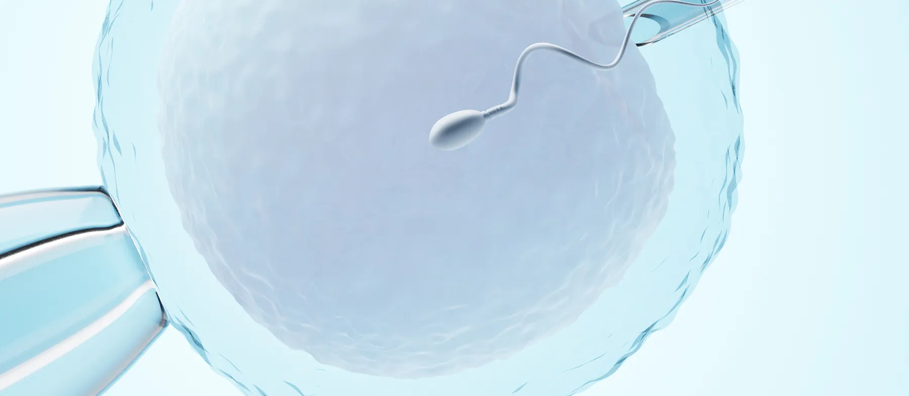 IVF